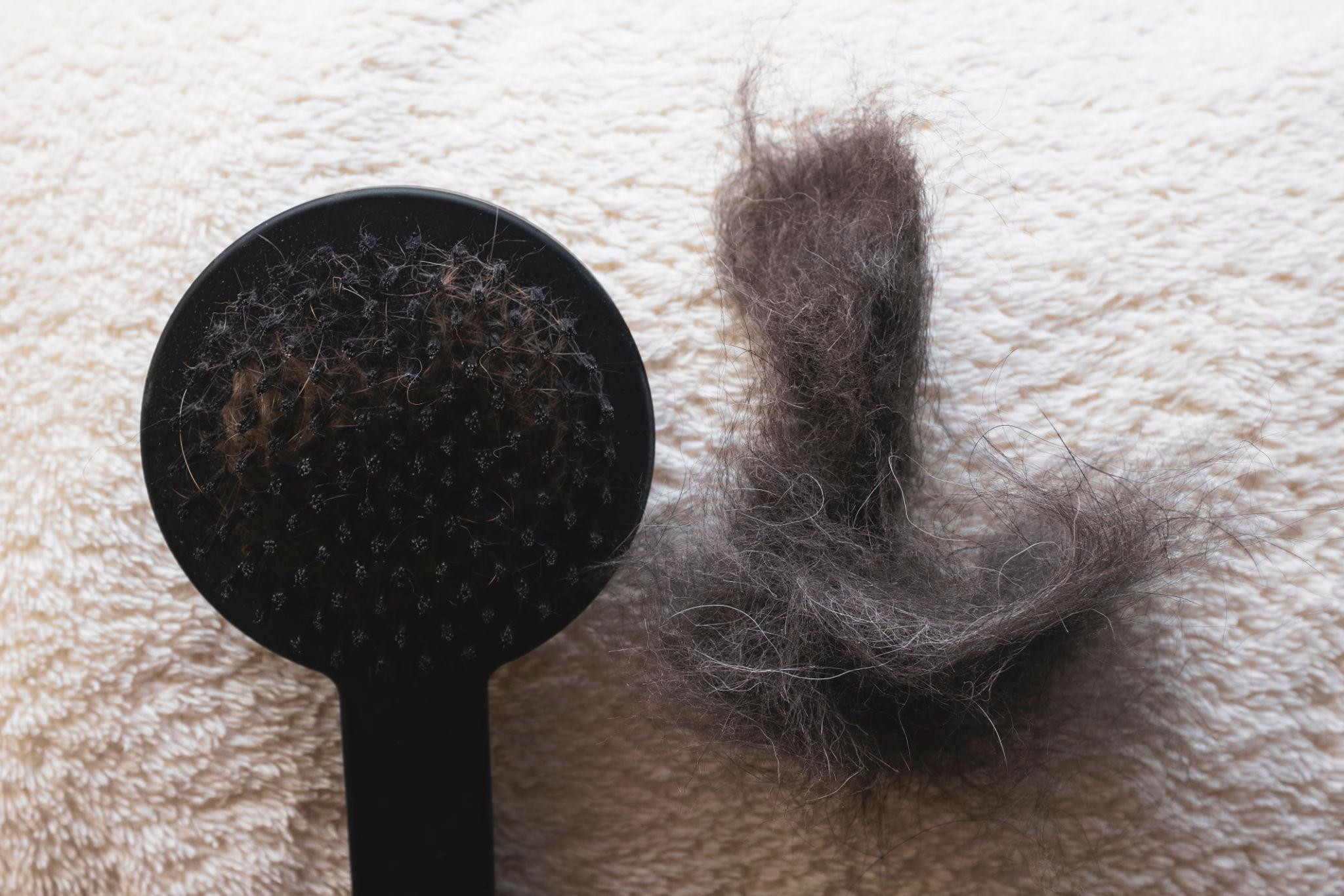 Pet Hair Remover Brush – Remove Fur in Seconds 🐾